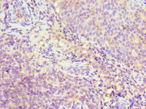 Immunohistochemistry of paraffin-embedded human tonsil tissue using CSB-PA021156ESR1HU at dilution of 1:100