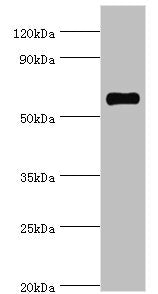 Western blot All lanes: SRSF4 antibody at 4µg/ml + Hela whole cell lysate Secondary Goat polyclonal to rabbit IgG at 1/10000 dilution Predicted band size: 57 kDa Observed band size: 57 kDa