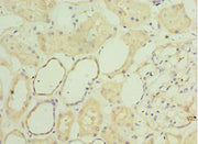 Immunohistochemistry of paraffin-embedded human kidney tissue using CSB-PA021200ESR1HU at dilution of 1:100