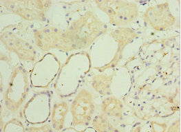 Immunohistochemistry of paraffin-embedded human kidney tissue using CSB-PA021200ESR1HU at dilution of 1:100