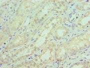 Immunohistochemistry of paraffin-embedded human kidney tissue using CSB-PA021204ESR2HU at dilution of 1:100