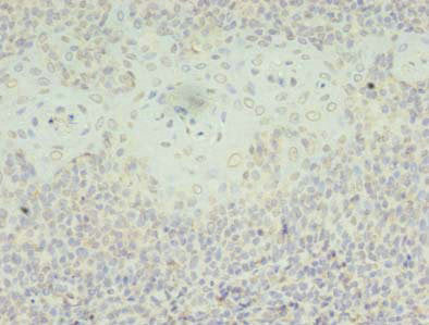 Immunohistochemistry of paraffin-embedded human tonsil tissue using CSB-PA021220LA01HU at dilution of 1:100