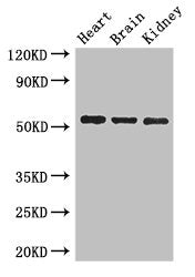 Western Blot Positive WB detected in: Mouse heart tissue, Mouse brain tissue, Mouse kidney tissue All lanes: SH3BP5 antibody at 3ug/ml Secondary Goat polyclonal to rabbit IgG at 1/50000 dilution Predicted band size: 51, 33 kDa Observed band size:...