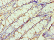 Immunohistochemistry of paraffin-embedded human colon tissue using CSB-PA021272ESR2HU at dilution of 1:100