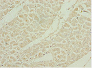 Immunohistochemistry of paraffin-embedded human heart tissue using CSB-PA021277ESR2HU at dilution of 1:100