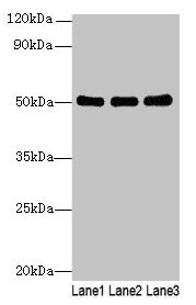 Western blot All lanes: SIGLEC6 antibody at 6µg/ml Lane 1: Human high value serum Lane 2: A549 whole cell lysate Lane 3: Caco-2 whole cell lysate Secondary Goat polyclonal to rabbit IgG at 1/10000 dilution Predicted band size: 50, 39, 49, 38, 43,...