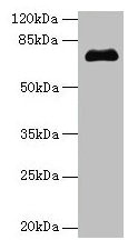 Western blot All lanes: PMEL antibody at 14µg/ml + Jurkat whole cell lysate Secondary Goat polyclonal to rabbit IgG at 1/10000 dilution Predicted band size: 71, 61, 67 kDa Observed band size: 71 kDa