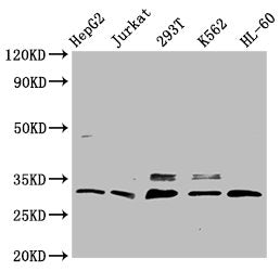 Western Blot Positive WB detected in: HepG2 whole cell lysate, Jurkat whole cell lysate, 293T whole cell lysate, K562 whole cell lysate, HL-60 whole cell lysate All lanes: GEMIN2 antibody at 3.7µg/ml Secondary Goat polyclonal to rabbit IgG at 1/50...