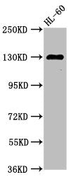 Western Blot Positive WB detected in: HL60 whole cell lysate All lanes: SIPA1 antibody at 2.7µg/ml Secondary Goat polyclonal to rabbit IgG at 1/50000 dilution Predicted band size: 112 kDa Observed band size: 130 kDa