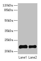 Western blot All lanes: SIRPD antibody at 14µg/ml Lane 1: 293T whole cell lysate Lane 2: Mouse spleen tissue Secondary Goat polyclonal to rabbit IgG at 1/10000 dilution Predicted band size: 22 kDa Observed band size: 22 kDa