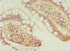 Immunohistochemistry of paraffin-embedded human small intestine tissue using CSB-PA021347ESR1HU at dilution of 1:100