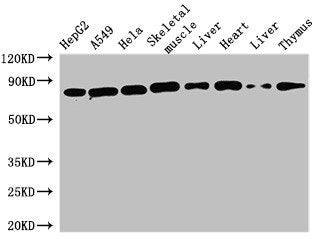 Western Blot Positive WB detected in: HepG2 whole cell lysate, A549 whole cell lysate, Hela whole cell lysate, Mouse skeletal muscle tissue, Mouse liver tissue, Rat heart tissue, Rat liver tissue, Rat thymus tissue All lanes: SKIL antibody at 1.6µ...