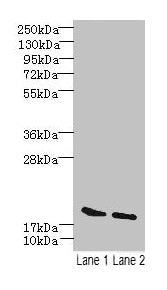 Western blot All lanes: SKP1 antibody at 15µg/ml Lane 1: Mouse brain tissue Lane 2: Hela whole cell lysate Secondary Goat polyclonal to rabbit IgG at 1/10000 dilution Predicted band size: 19 kDa Observed band size: 19 kDa