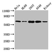 Western Blot Positive WB detected in: Hela whole cell lysate, HL60 whole cell lysate, 293T whole cell lysate, A549 whole cell lysate, Mouse kidney tissue All lanes: SLAMF6 antibody at 5.1ug/ml Secondary Goat polyclonal to rabbit IgG at 1/50000 dil...