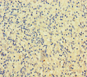 Immunohistochemistry of paraffin-embedded human spleen tissue using CSB-PA021370LA01HU at dilution of 1:100