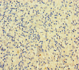 Immunohistochemistry of paraffin-embedded human spleen tissue using CSB-PA021370LA01HU at dilution of 1:100