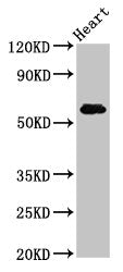 Western Blot Positive WB detected in: Rat heart tissue All lanes: SLC11A1 antibody at 5ug/ml Secondary Goat polyclonal to rabbit IgG at 1/50000 dilution Predicted band size: 60, 48 kDa Observed band size: 60 kDa