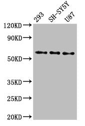 Western Blot Positive WB detected in: 293 whole cell lysate, SH-SY5Y whole cell lysate, U87 whole cell lysate All lanes: SLC11A2 antibody at 3ug/ml Secondary Goat polyclonal to rabbit IgG at 1/50000 dilution Predicted band size: 63, 62, 65, 66 kDa...