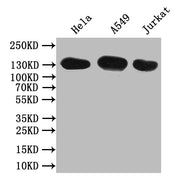 Western Blot Positive WB detected in: Hela whole cell lysate,A549 whole cell lysate,JK whole cell lysate All lanes: SLC12A2 antibody at 1:1000 Secondary Goat polyclonal to rabbit IgG at 1/50000 dilution Predicted band size: 132 kDa Observed band s...