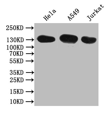 Western Blot Positive WB detected in: Hela whole cell lysate,A549 whole cell lysate,JK whole cell lysate All lanes: SLC12A2 antibody at 1:1000 Secondary Goat polyclonal to rabbit IgG at 1/50000 dilution Predicted band size: 132 kDa Observed band s...