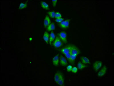Immunofluorescence staining of Hela cells with CSB-PA021384LA01HU at 1:100, counter-stained with DAPI. The cells were fixed in 4% formaldehyde, permeabilized using 0.2% Triton X-100 and blocked in 10% normal Goat Serum. The cells were then incubat...