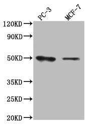 Western Blot Positive WB detected in: PC-3 whole cell lysate, MCF7 whole cell lysate All lanes:SLC16A3 Antibody at 1:1000 Secondary Goat polyclonal to rabbit IgG at 1/50000 dilution Predicted band size:50 kDa Observed band size:50 kDa
