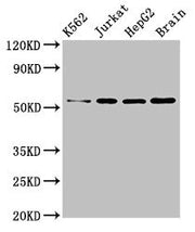 Western Blot Positive WB detected in: K562 whole cell lysate, Jurkat whole cell lysate, HepG2 whole cell lysate, Mouse brain tissue All lanes: SLC16A8 antibody at 3µg/ml Secondary Goat polyclonal to rabbit IgG at 1/50000 dilution Predicted band si...