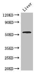 Western Blot Positive WB detected in: Mouse liver tissue All lanes: SLC18A1 antibody at 2.7ug/ml Secondary Goat polyclonal to rabbit IgG at 1/50000 dilution Predicted band size: 57, 51, 53 kDa Observed band size: 57 kDa