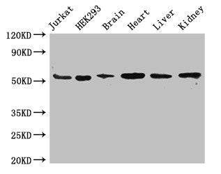 Western Blot Positive WB detected in: Jurkat whole cell lysate, HEK293 whole cell lysate, Mouse brain tissue, Mouse heart tissue, Mouse liver tissue, Mouse kidney tissue All lanes: SLC18A2 antibody at 3.4ug/ml Secondary Goat polyclonal to rabbit I...