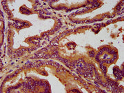 IHC image of CSB-PA021430LA01HU diluted at 1:300 and staining in paraffin-embedded human prostate tissue performed on a Leica BondTM system. After dewaxing and hydration, antigen retrieval was mediated by high pressure in a citrate buffer (pH 6.0)...