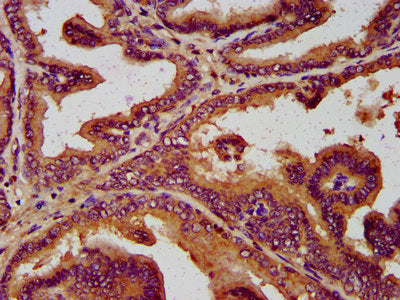 IHC image of CSB-PA021430LA01HU diluted at 1:300 and staining in paraffin-embedded human prostate tissue performed on a Leica BondTM system. After dewaxing and hydration, antigen retrieval was mediated by high pressure in a citrate buffer (pH 6.0)...