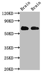 Western Blot Positive WB detected in: Rat brain tissue, Mouse brain tissue All lanes: SLC1A2 antibody at 3.2ug/ml Secondary Goat polyclonal to rabbit IgG at 1/50000 dilution Predicted band size: 63, 62 kDa Observed band size: 63 kDa