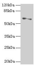 Western blot All lanes: SLC1A6 antibody at 2µg/ml + A375 whole cell lysate Secondary Goat polyclonal to rabbit IgG at 1/10000 dilution Predicted band size: 62, 35 kDa Observed band size: 62 kDa