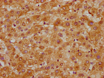 IHC image of CSB-PA021438EA01HU diluted at 1:300 and staining in paraffin-embedded human liver tissue performed on a Leica BondTM system. After dewaxing and hydration, antigen retrieval was mediated by high pressure in a citrate buffer (pH 6.0). S...