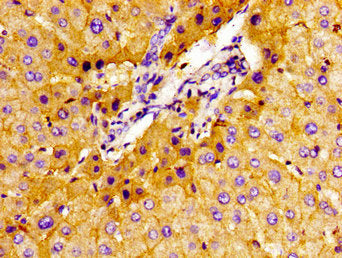 Immunohistochemistry of paraffin-embedded human liver tissue using CSB-PA021442LA01HU at dilution of 1:100