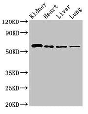 Western Blot Positive WB detected in: Mouse kidney tissue, Rat heart tissue, Rat liver tissue, Rat lung tissue All lanes: SLC22A2 antibody at 2.7ug/ml Secondary Goat polyclonal to rabbit IgG at 1/50000 dilution Predicted band size: 63, 55, 27 kDa...
