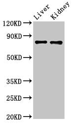 Western Blot Positive WB detected in: Mouse liver tissue, Mouse kidney tissue All lanes: SLC22A23 antibody at 5.2ug/ml Secondary Goat polyclonal to rabbit IgG at 1/50000 dilution Predicted band size: 74, 45, 35, 39 kDa Observed band size: 74 kDa