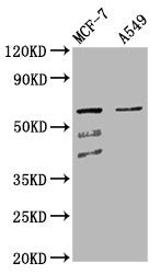 Western Blot Positive WB detected in: MCF-7 whole cell lysate, A549 whole cell lysate All lanes: SLC22A5 antibody at 4.3µg/ml Secondary Goat polyclonal to rabbit IgG at 1/50000 dilution Predicted band size: 63, 25, 66 kDa Observed band size: 63 kDa