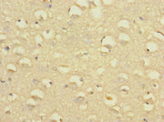 Immunohistochemistry of paraffin-embedded human brain tissue using CSB-PA021469ESR1HU at dilution of 1:100