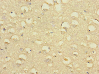 Immunohistochemistry of paraffin-embedded human brain tissue using CSB-PA021469ESR1HU at dilution of 1:100
