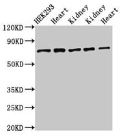 Western Blot Positive WB detected in: HEK293 whole cell lysate, Rat heart tissue, Rat kidney tissue, Mouse kidney tissue, Mouse heart tissue All lanes: SLC25A12 antibody at 3µg/ml Secondary Goat polyclonal to rabbit IgG at 1/50000 dilution Predict...