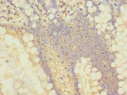 Immunohistochemistry of paraffin-embedded human small intestine tissue using CSB-PA021510LA01HU at dilution of 1:100