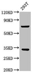 Western Blot Positive WB detected in: 293T whole cell lysate All lanes: SLC25A5 antibody at 3.5ug/ml Secondary Goat polyclonal to rabbit IgG at 1/50000 dilution Predicted band size: 33 kDa Observed band size: 33 kDa