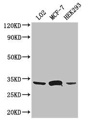 Western Blot Positive WB detected in: LO2 whole cell lysate, MCF-7 whole cell lysate, HEK293 whole cell lysate All lanes: SLC25A6 antibody at 3ug/ml Secondary Goat polyclonal to rabbit IgG at 1/50000 dilution Predicted band size: 33 kDa Observed b...