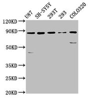 Western Blot Positive WB detected in: U87 whole cell lysate, SH-SY5Y whole cell lysate, 293T whole cell lysate, 293 whole cell lysate, Colo320 whole cell lysate All lanes: SLC26A4 antibody at 5.7µg/ml Secondary Goat polyclonal to rabbit IgG at 1/5...