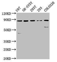 Western Blot Positive WB detected in: U87 whole cell lysate, SH-SY5Y whole cell lysate, 293T whole cell lysate, 293 whole cell lysate, Colo320 whole cell lysate All lanes: SLC26A4 antibody at 5.7µg/ml Secondary Goat polyclonal to rabbit IgG at 1/5...