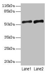Western blot All lanes: SLC2A4 antibody at 2µg/ml Lane 1: Mouse heart tissue Lane 2: Hela whole cell lysate Secondary Goat polyclonal to rabbit IgG at 1/10000 dilution Predicted band size: 55, 44 kDa Observed band size: 55 kDa