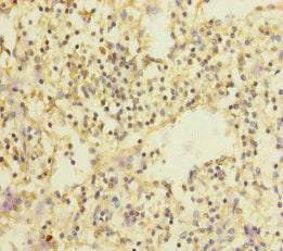 Immunohistochemistry of paraffin-embedded human spleen tissue using CSB-PA021583ESR1HU at dilution of 1:100