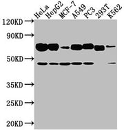 Western Blot Positive WB detected in: Hela whole cell lysate, HepG2 whole cell lysate, MCF-7 whole cell lysate, A549 whole cell lysate, PC3 whole cell lysate, 293T whole cell lysate, K562 whole cell lysate All lanes: SLC3A2 antibody at 1:2000 Seco...