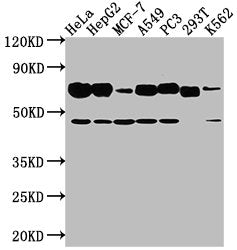 Western Blot Positive WB detected in: Hela whole cell lysate, HepG2 whole cell lysate, MCF-7 whole cell lysate, A549 whole cell lysate, PC3 whole cell lysate, 293T whole cell lysate, K562 whole cell lysate All lanes: SLC3A2 antibody at 1:2000 Seco...